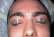 1314942085_creepy_eyeball_tattoos_17
