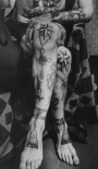 nakolki-na-nogah
